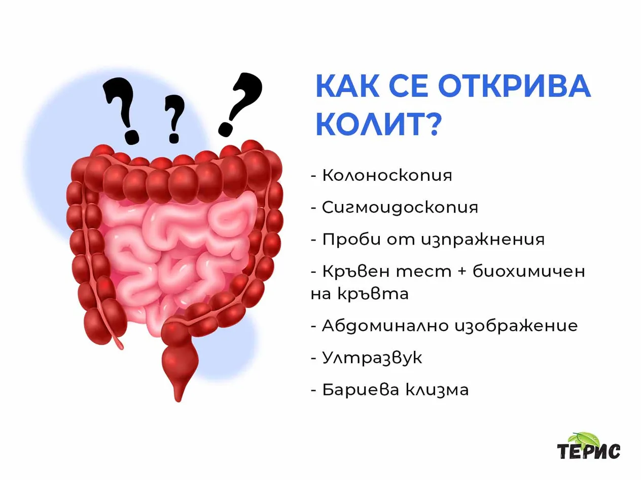 Как се открива колит?