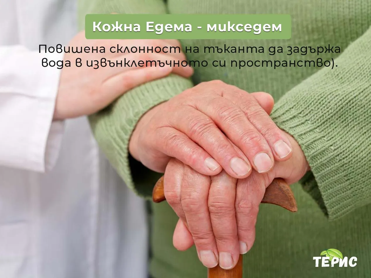 Кожна Едема - микседем