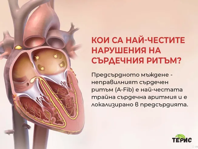 Кои са най-честите нарушения на сърдечния ритъм?