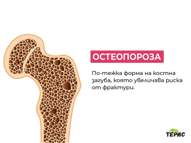 Остеопороза - по-тежка форма на костна загуба